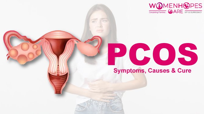 A Guide to hack PCOS